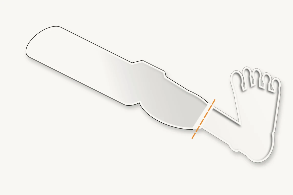 Anatomical illustration of an intact lower extremity with a proposed mid-calf amputation level